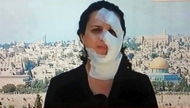 الصحفيات والصحفيين على خط النار مع الاحتلال