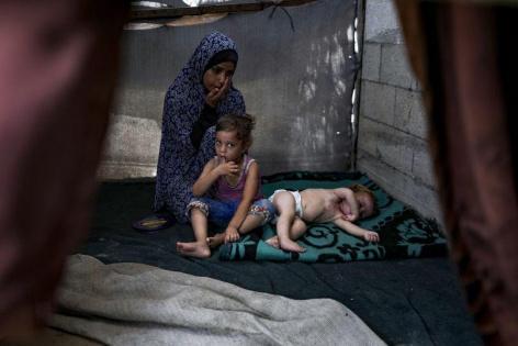 "الأونروا": مستويات قياسية لانتشار الأمراض في غزة بسبب البرد والحرمان من اللقاحات


