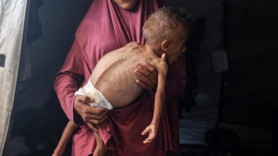 5 وفيات بينهم طفل نتيجة المجاعة وسوء التغذية خلال الساعات الـ24 الماضية

