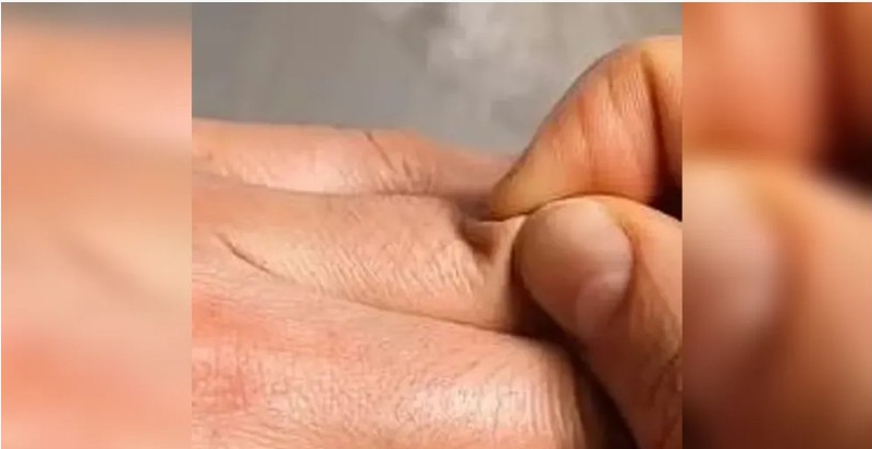 اختبار بسيط على الجلد سيخبرك.. هل تشرب كمية كافية من الماء؟
