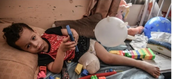 15 ألف مبتور أطرافهم واحتياجات طبية عاجلة في غزة

