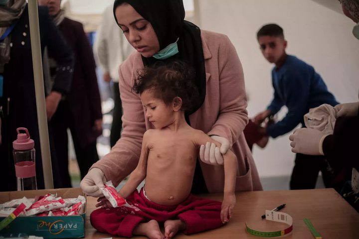 "اليونيسف": 112 طفلًا يدخلون دائرة سوء التغذية يوميًا في قطاع غزة
