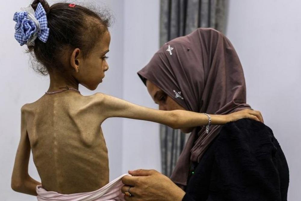 "الأغذية العالمي": نصف مليون فلسطيني في غزة على شفا المجاعة
