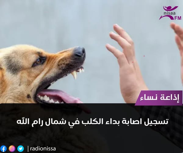 منذ مطلع العام: تسجيل 6 إصابات بداء الكلب وحالات العض تجاوزت الـ1000 حالة في الضفة
