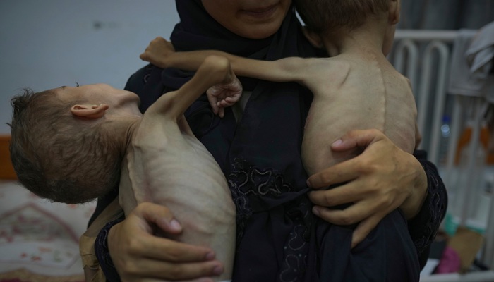"آكشن إيد": 7 من كل 10 نساء حوامل ومرضعات في غزة يعانين من سوء التغذية
