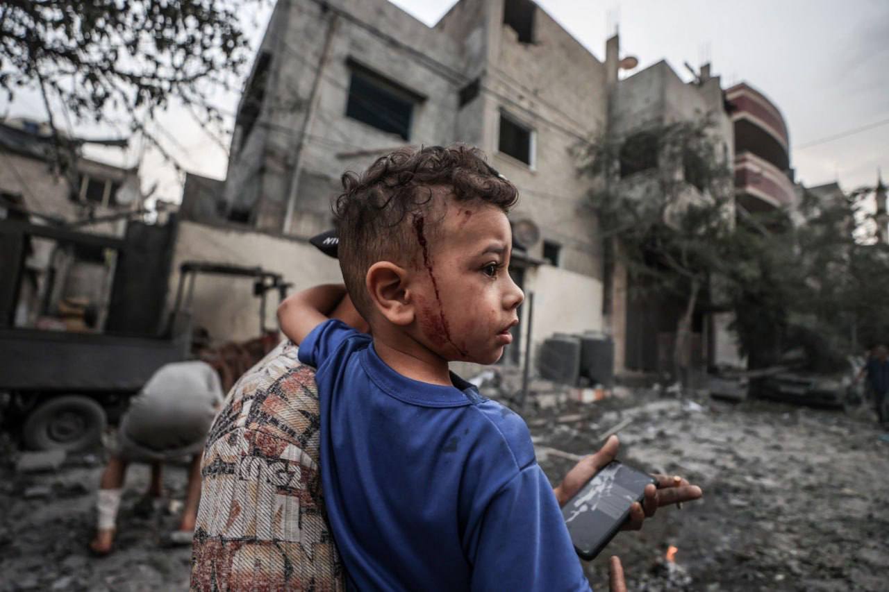 بعد خروجها.. ممرضة أمريكية تصف لـCNN الأوضاع الصحية في غزة وتسأل زملاءها: "هل أنتم على قيد الحياة؟"
