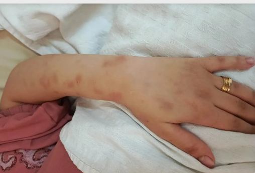 الأردن.. عائلة سيدة في الزرقاء تتهم زوجها بتعذيبها حتى وفاتها
