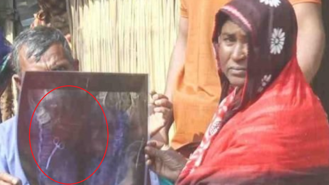 قصة مأساوية.. مقص جراحي منسي في بطن سيدة منذ 20 عاماً

