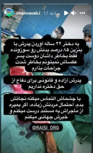 إيراني يضرم النار في جسد ابنته لصداقتها مع شاب

