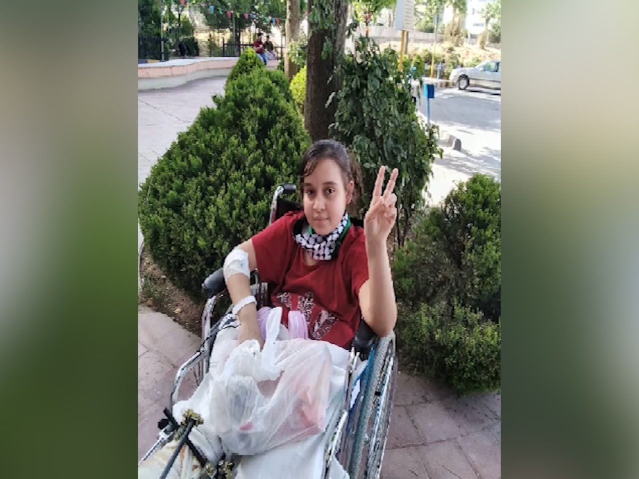 صوت| الطفلة فرح إسليم.. العودة الى الحياة بطرف صناعي !!

