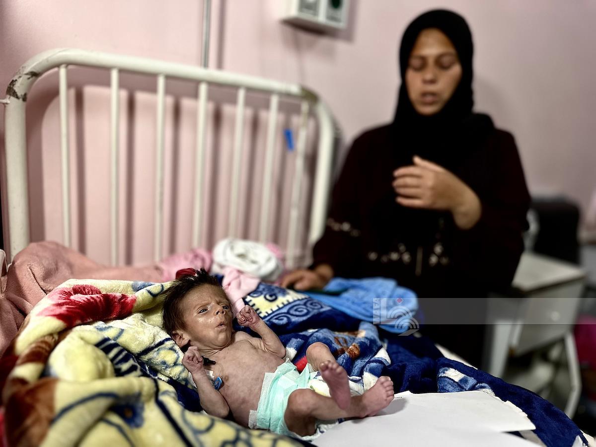 5 وفيات بينهم طفلان نتيجة المجاعة وسوء التغذية في قطاع غزة
