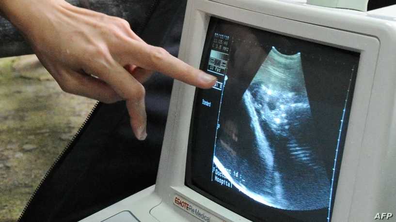 سابقة علمية.. جنين ينمو بنجاح خارج رحم أمه في إسرائيل
