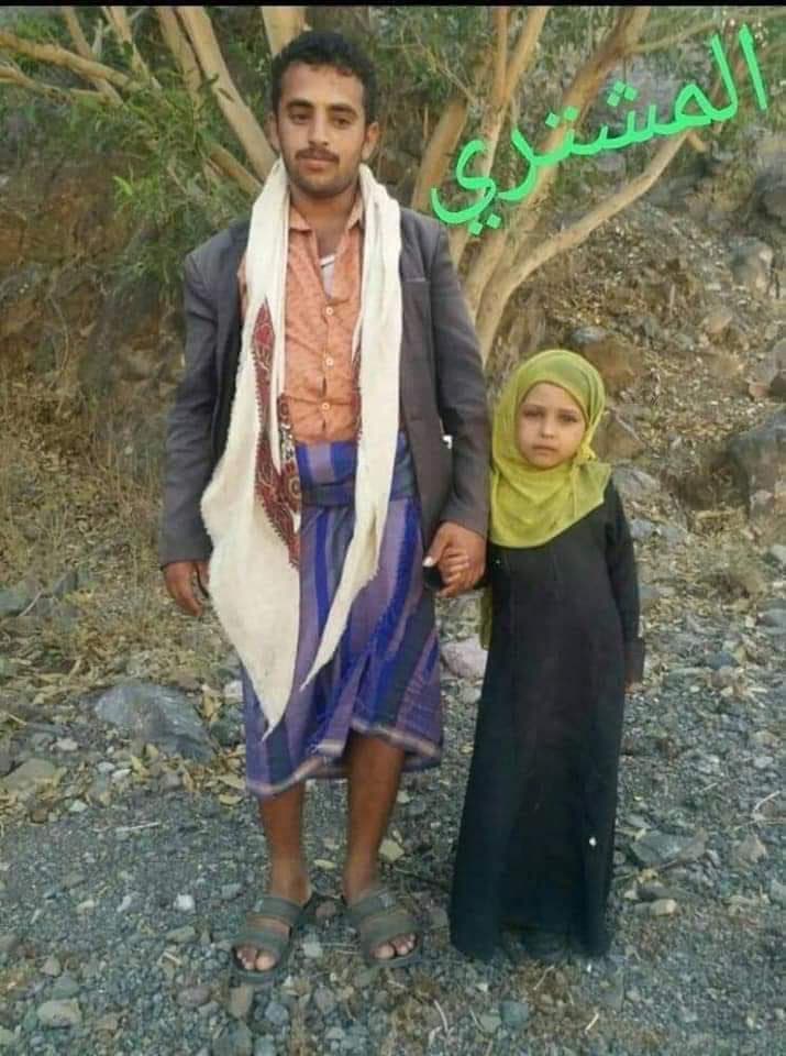 مأساة أثارت ضجة.. أب يمني يبيع طفلته "ليمونة" بـ350 دولار وبعقد رسمي
