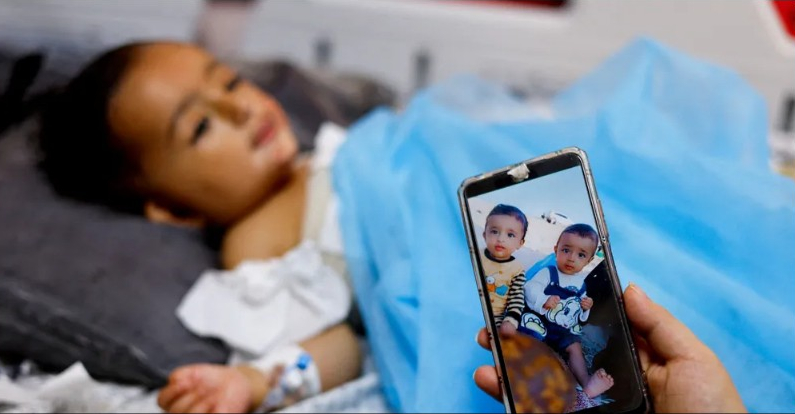 مأساة توأمين في غزة.. فقدا أمهما وانفصلا إثر غارة إسرائيلية
