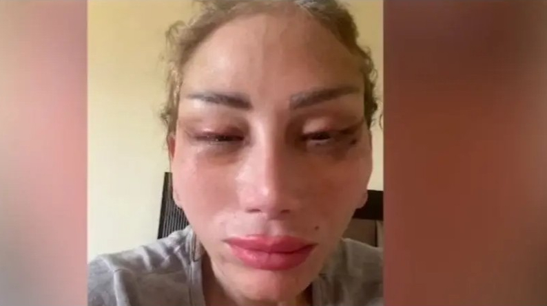 بالفيديو.. ريهام سعيد تكشف كيف تشوهت على يد طبيب تجميل شهير

