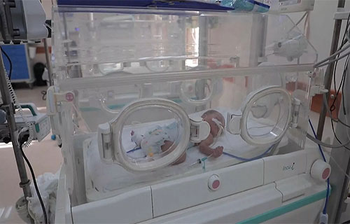 الحمل في غزة تجربة مريرة تزداد صعوبتها خلال الولادة
