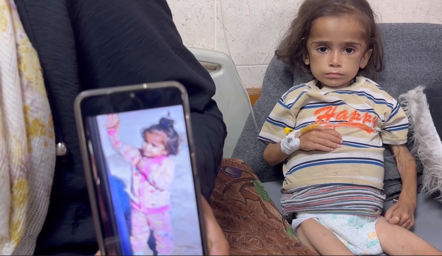 سبيل.. رضيعة تلخص بجسدها الموجوع ما يعانيه قطاع غزة المدمر

