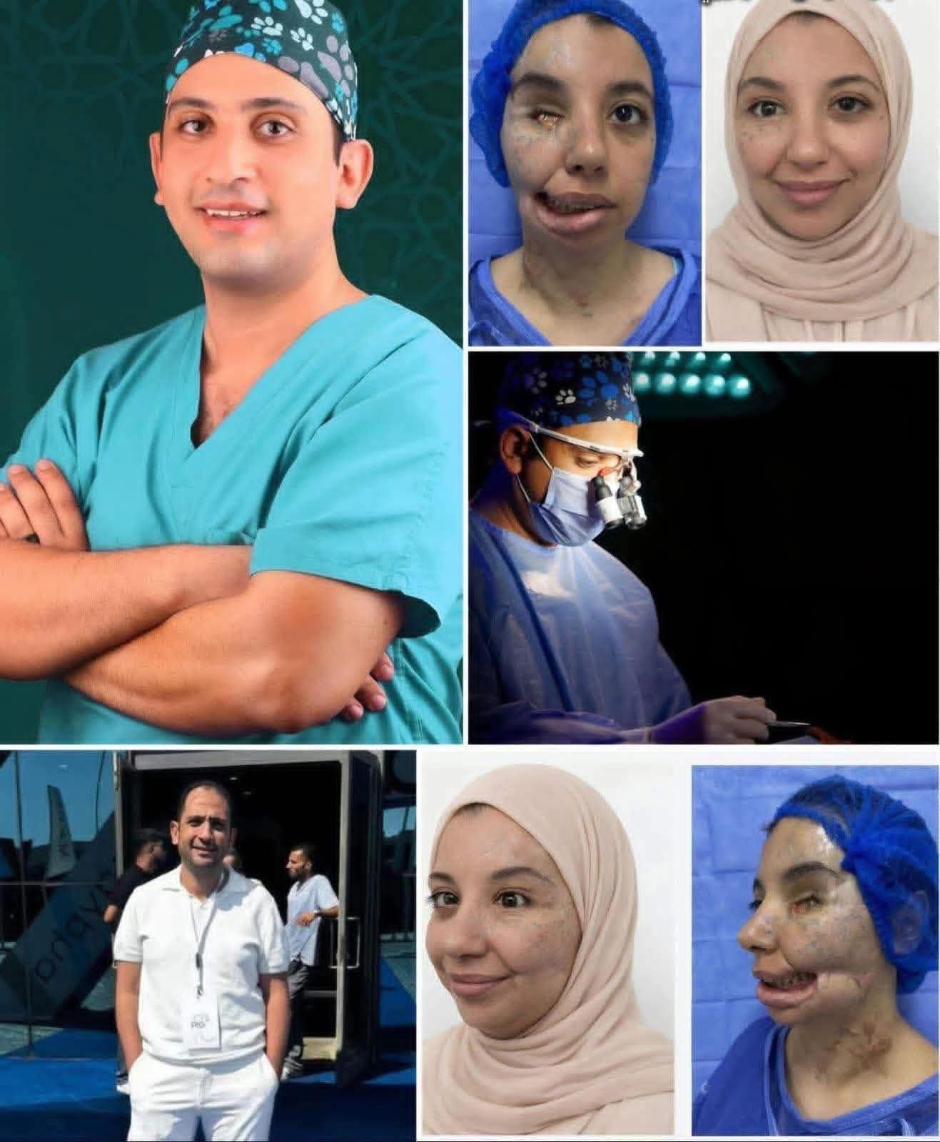 إنجاز طبي نادر لجراح مصري يعيد ملامح وجه فتاة من غزة
