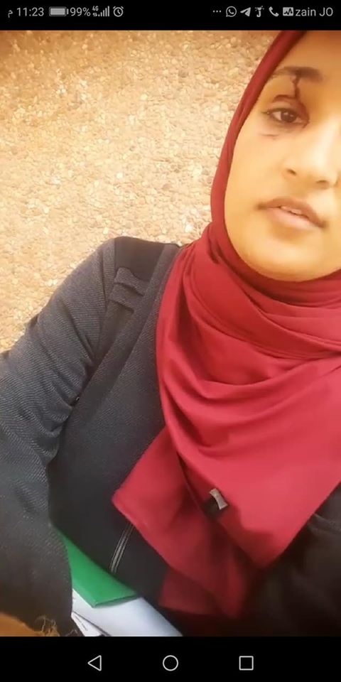 شاهد.. فتاة غزية تتعرض للضرب على يد أخيها.. فتشتكيه للشرطة وتُصور كدماتها عبر (فيسبوك)
