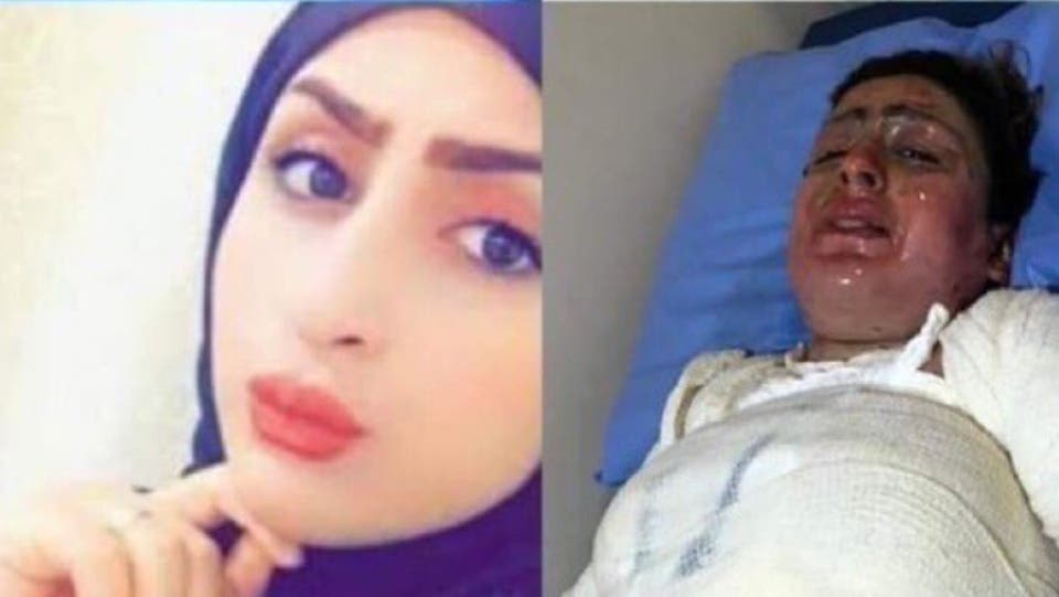 مأساة تحبس الأنفاس.. ابنة النجف حرقت نفسها وزوجها يشاهد
