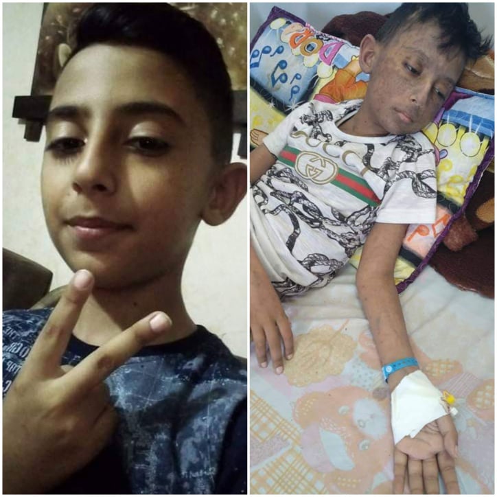 صوت| الطفل المريض مياس فوزي.. يطلق صرخة أخيرة لإنقاذ حياته والرئيس يستجيب !
