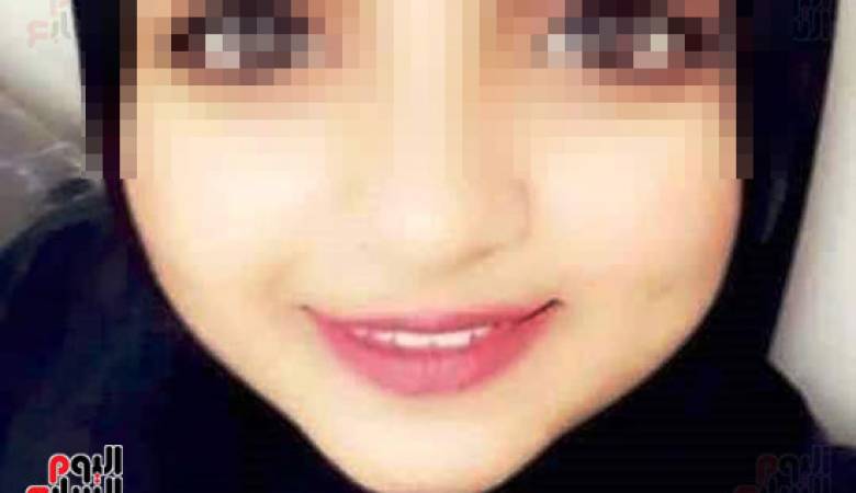 شاب يسكب ماء النار على وجه خطيبته بعد فسخ الخطوبة
