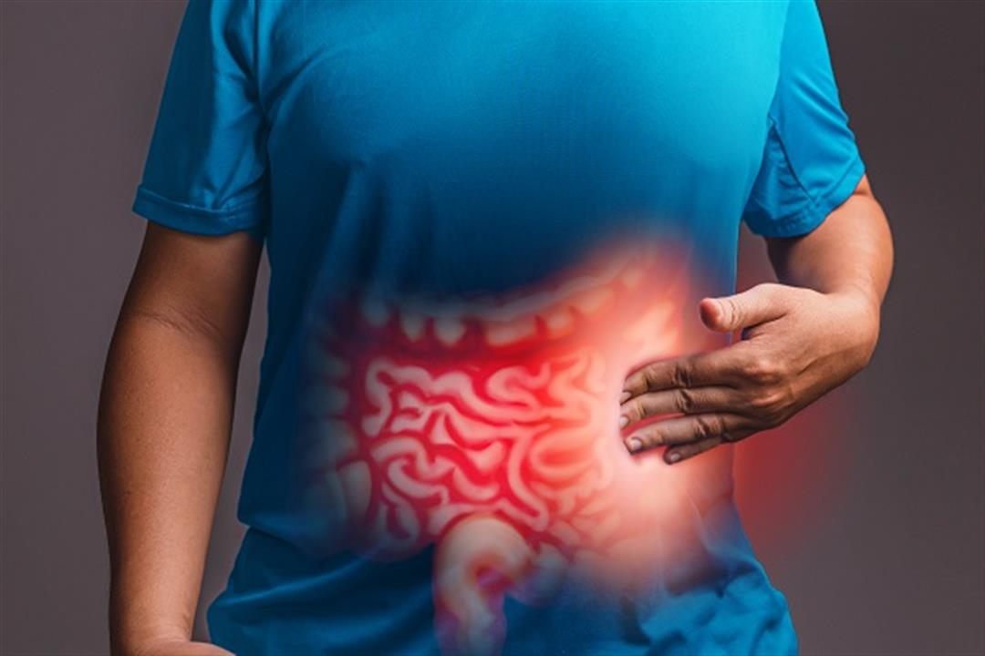 مشاكل الأمعاء وآلام البطن أكثر شيوعاً عند النساء.. لماذا؟
