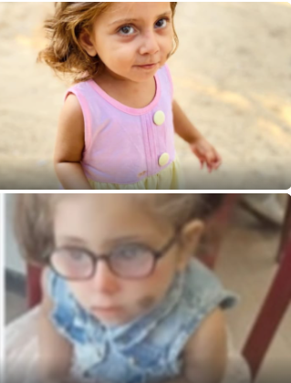 الطفلة الغزية سيلا قد تفقد بصرها بسبب الإغلاق

