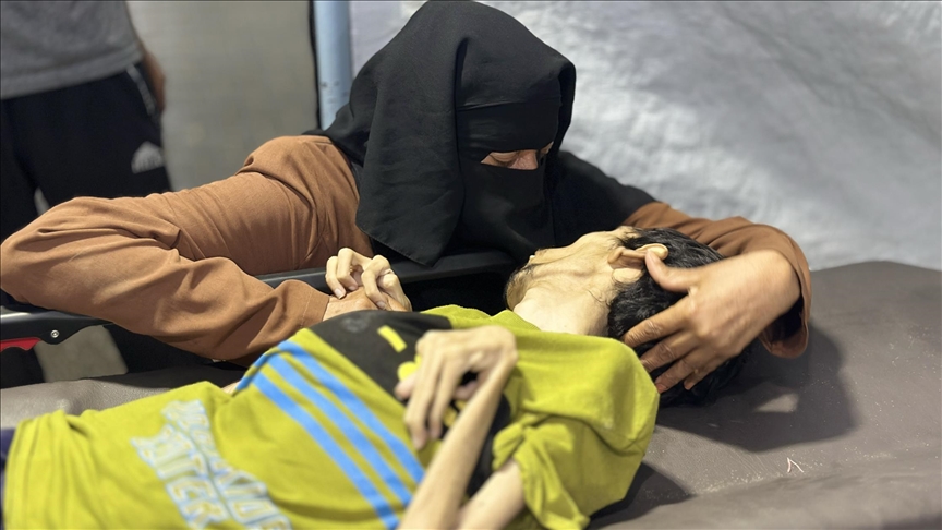 وفاة شاب بسبب سوء التغذية والمجاعة في غزة
