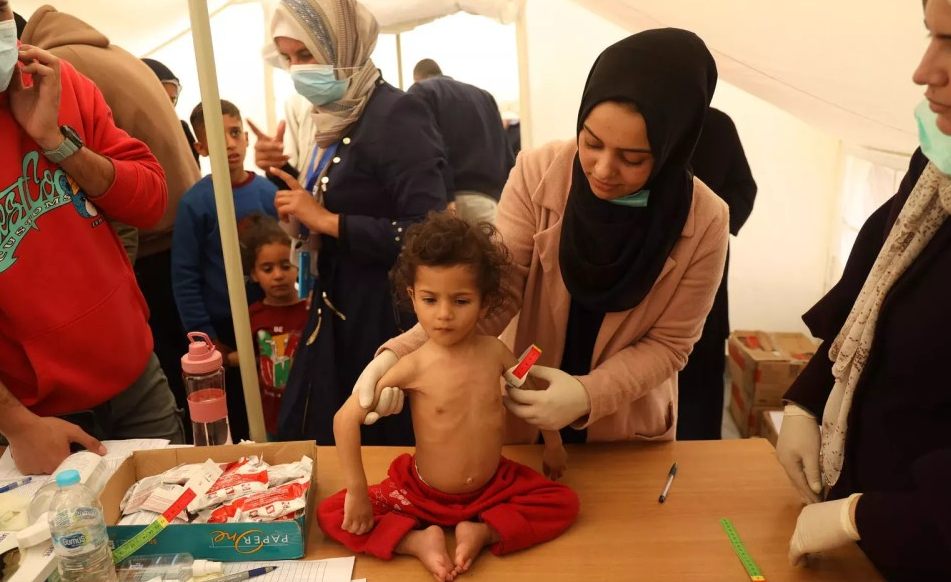 "الأونروا": أكثر من 2700 طفل في غزة أصيبوا بسوء تغذية حاد
