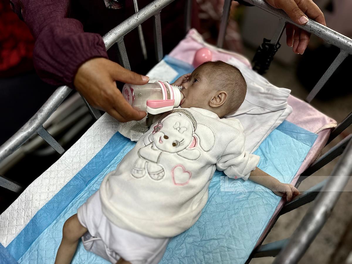 67 طفلا في غزة استشهدوا بسبب سوء التغذية وأكثر من 650 ألفا في خطر مباشر

