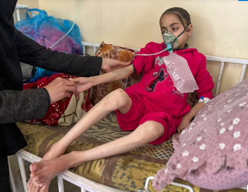 غزة: 326 وفاة بسبب سوء التغذية ونقص الدواء وأكثر من 300 حالة إجهاض خلال 80 يوما من الحصار
