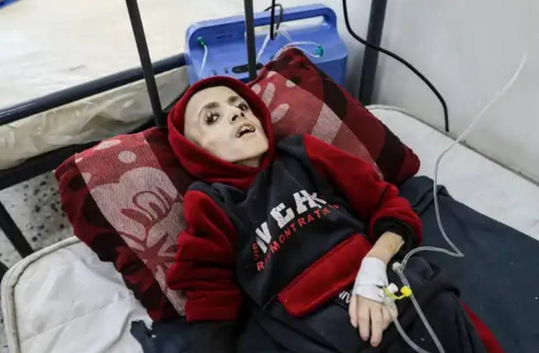 بلا علاج أو غذاء.. ساعة واحدة تفصل بين وفاة طفلين شقيقين بغزة
