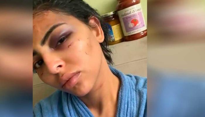الشارع الكويتي يهتز على أبشع قضية اغتصاب بحق سيدة مصرية

