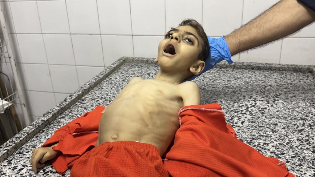 "سلاح التجويع" الإسرائيلي يودي بحياة طفل في غزة
