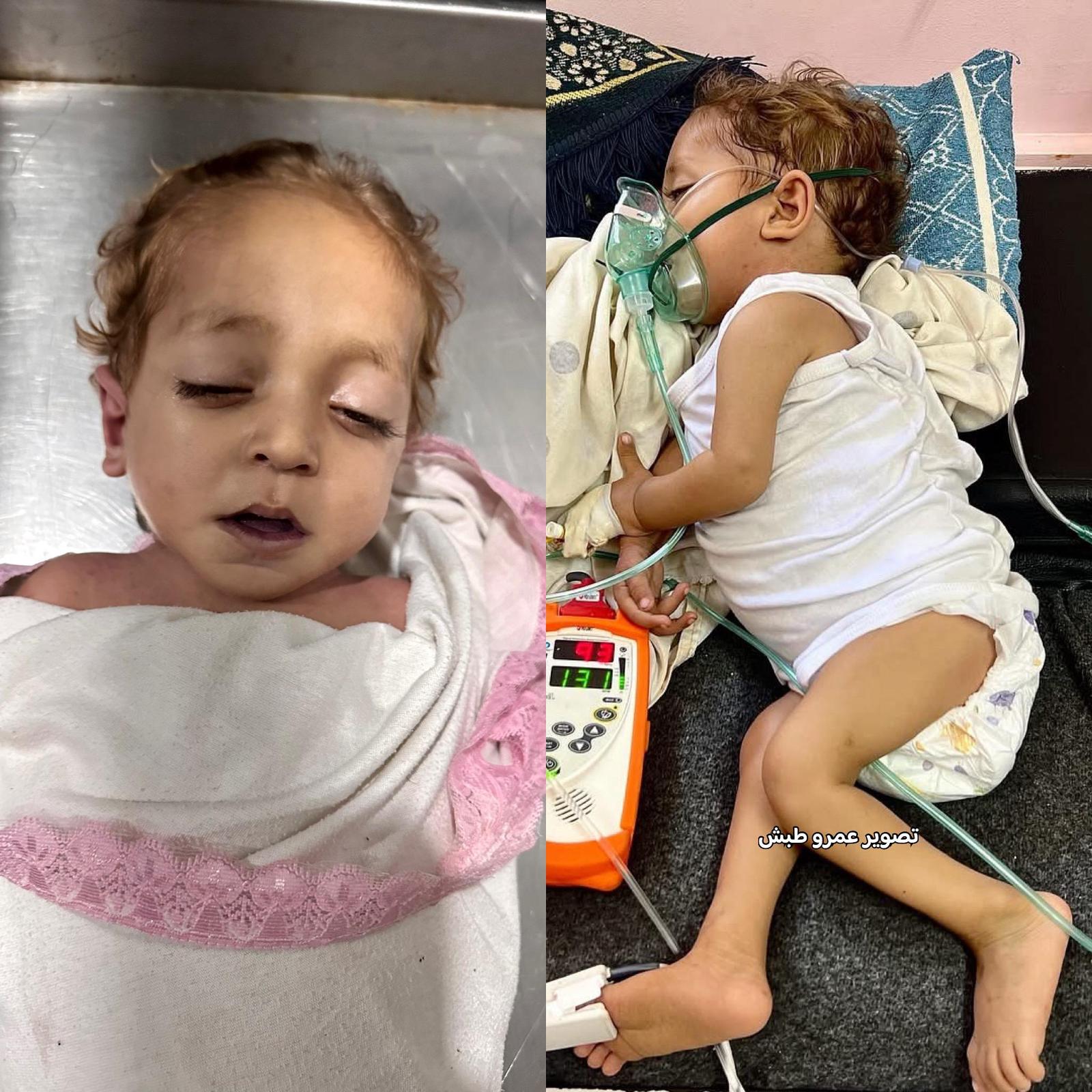 وفاة الطفل حسن بربخ من قطاع غزة نتيجة حرمانه من العلاج ليلحق بشقيقه الذي واجه نفس المصير

