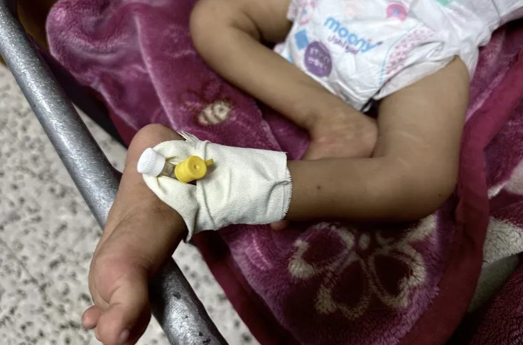 نساء غزة: 300 حالة إجهاض جراء نقص الغذاء 

