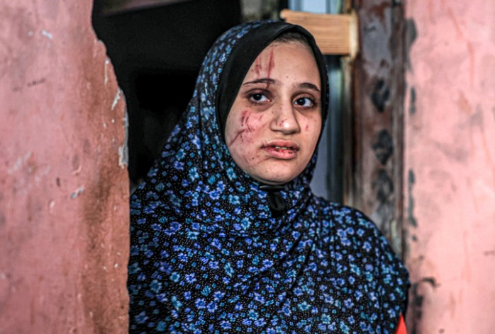 ظروف الحمل والولادة في قطاع غزة "أسوأ من جهنم"
