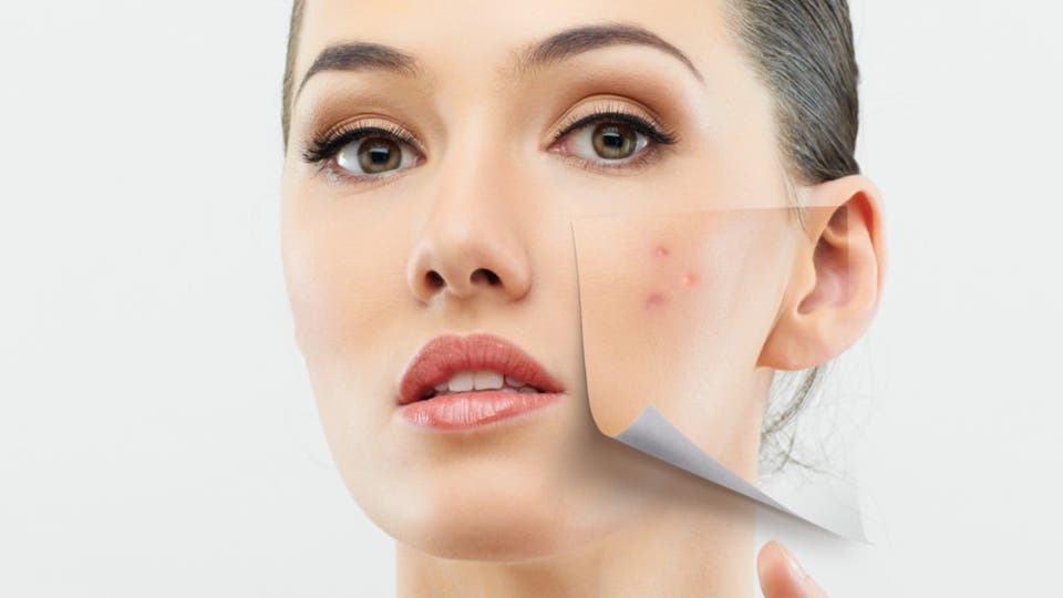 9 أطعمة قد تتسبب بظهور البثور على البشرة
