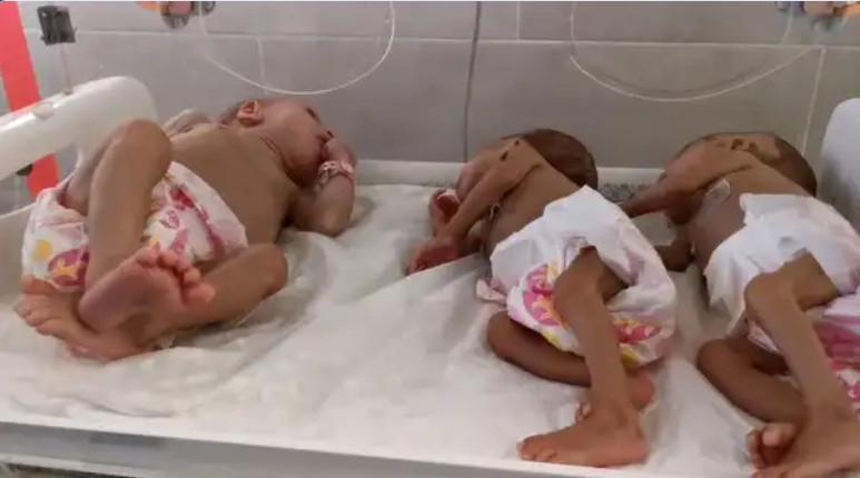 الأمم المتحدة تحذر من انفجار عدد وفيات الأطفال في غزة
