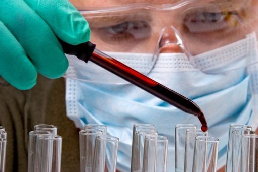 الصحة العالمية: انتشار السرطان سيزداد 75% ... نشرت منظمة الصحة العالمية "WHO" اليوم الثلاثاء تقديرات سوداوية تتعلق بمدى انتشار أمراض السرطان والزيادة المتوقعة على مستويات الانتشار مستقبلا، خاصة ان السرطان مصنف حاليا كسبب أول للوفيات في العالم ما منحة صفة 