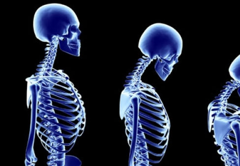 مؤسسة جذور تعقد اليوم العلمي حول "مرض هشاشة العظام"