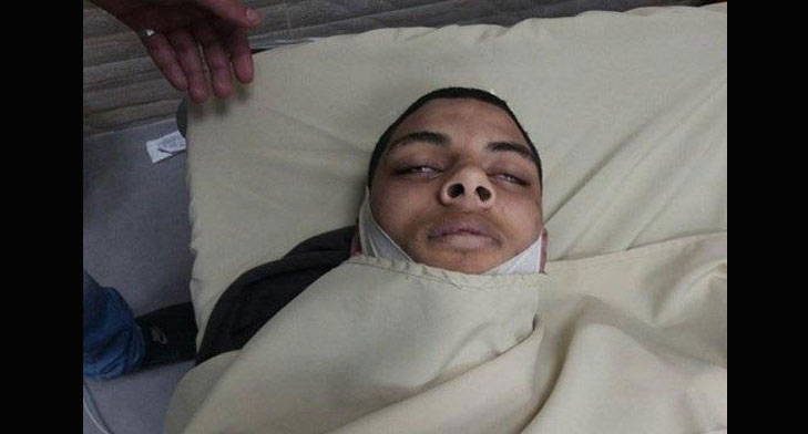 استشهاد شاب برصاص الاحتلال في مخيم الدهيشة