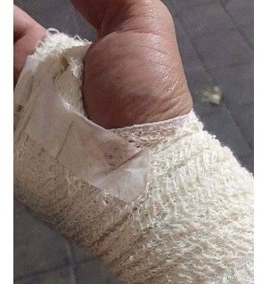 الشرطة تقبض على 6 اشخاص بتهمة الاعتداء على طبيب برام الله
